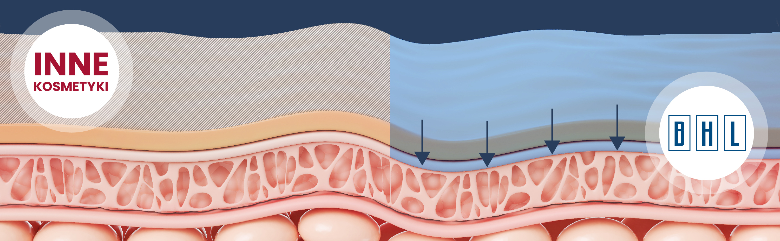 BHL sięga głęboko do niższych warstw naskórka
