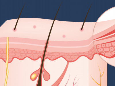 Bariera hydrolipidowa vs płaszcz hydrolipidowy